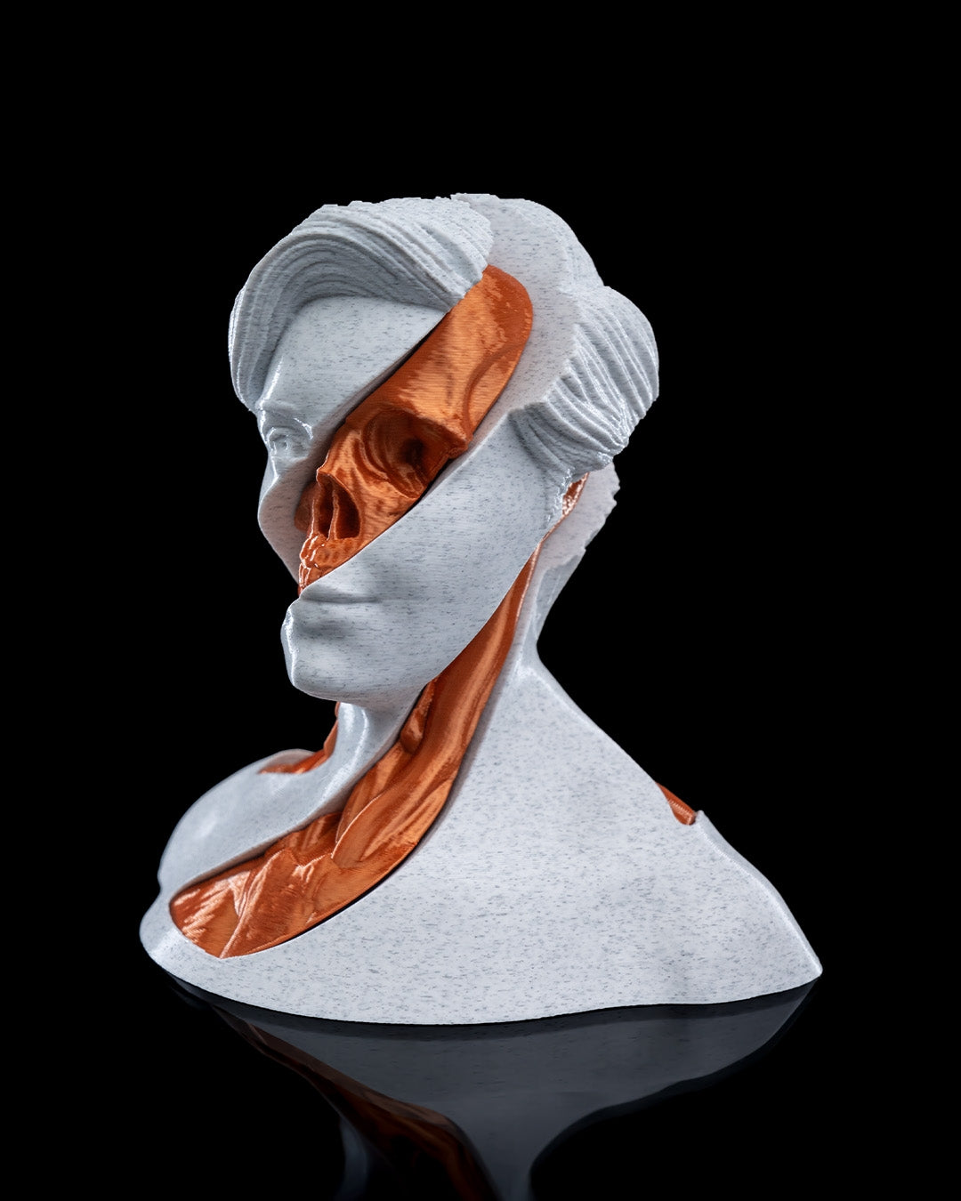 Whirls Anatomy Fidget