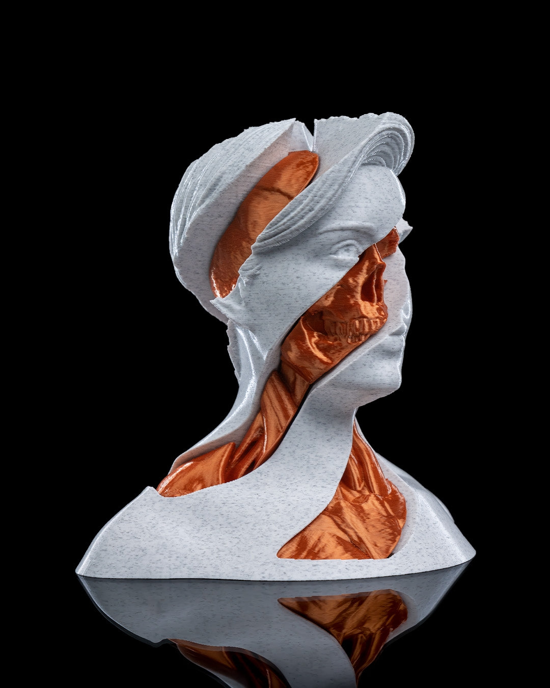 Whirls Anatomy Fidget