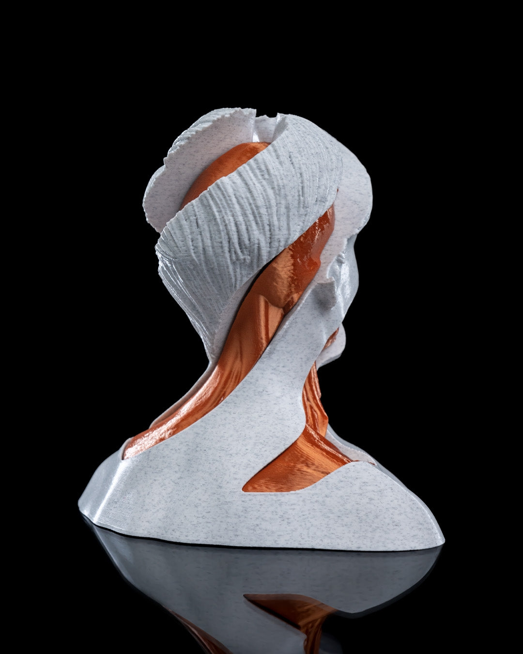 Whirls Anatomy Fidget